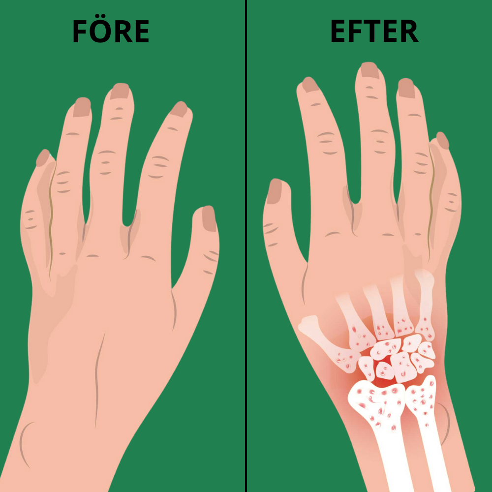 Handhjälpen - Lev som du lev innan smärtan utan väntande